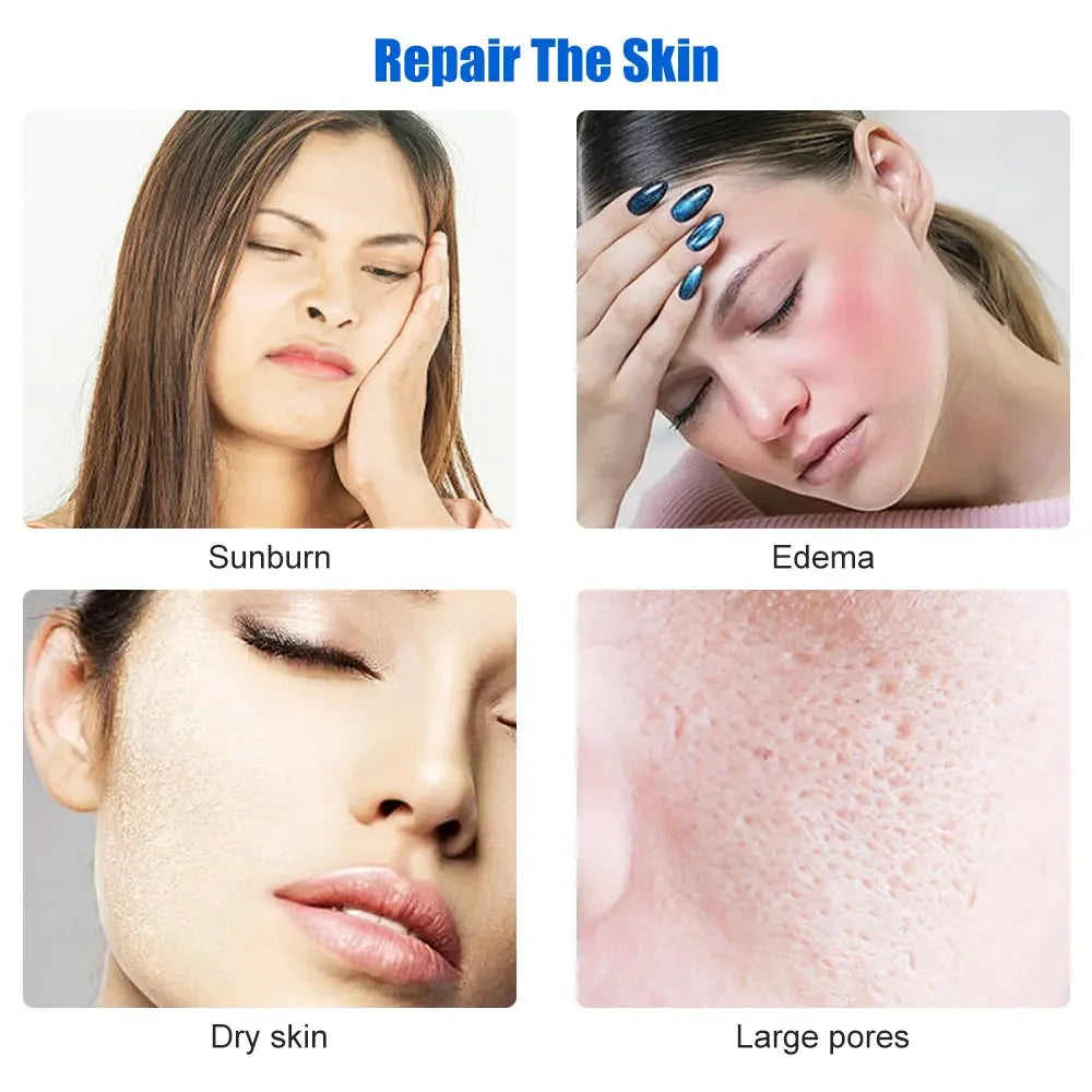 Ice Skin Lifter – Cool & Tighten Your Skin